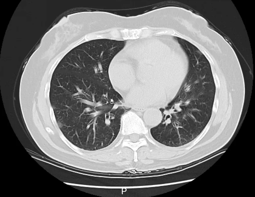 1741677310379348.png image.png